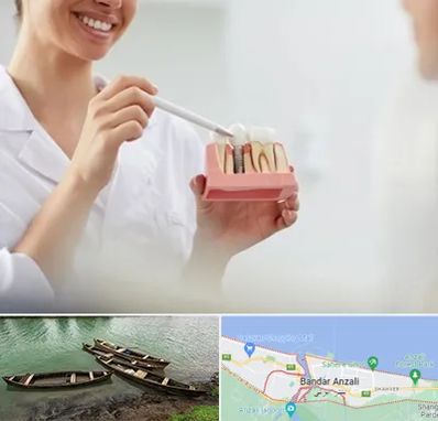 دکتر دندانساز در بندر انزلی