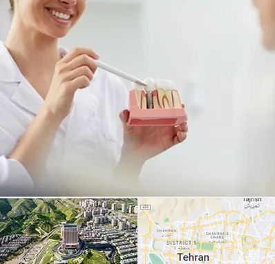 دکتر دندانساز در شمال تهران 