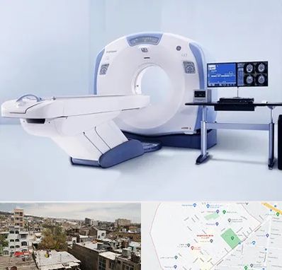 سی تی اسکن شبانه روزی در شمیران نو 