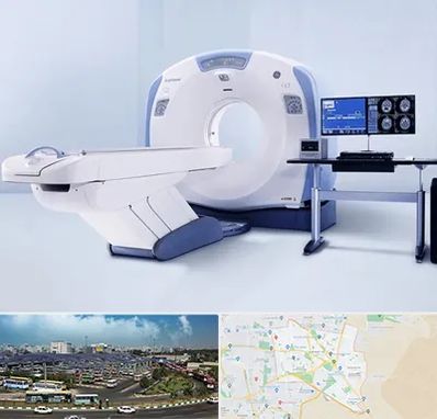 سی تی اسکن شبانه روزی در منطقه 15 تهران 