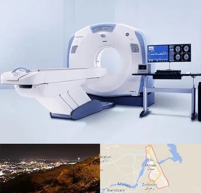 سی تی اسکن شبانه روزی در میناب