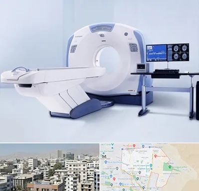 سی تی اسکن شبانه روزی در منطقه 14 تهران 