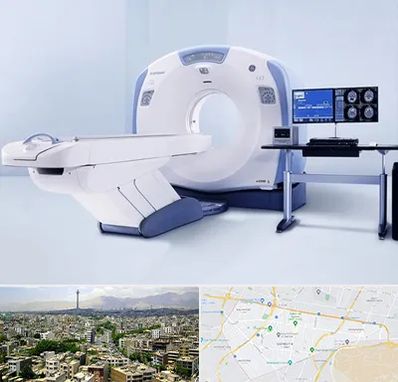 سی تی اسکن شبانه روزی در منطقه 8 تهران 