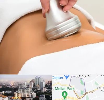 دستگاه لاغری در الهیه 