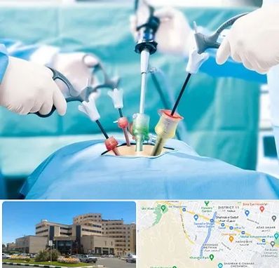 جراح فیبروم در صیاد شیرازی مشهد