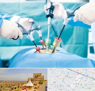 جراح فیبروم در هاشمیه مشهد