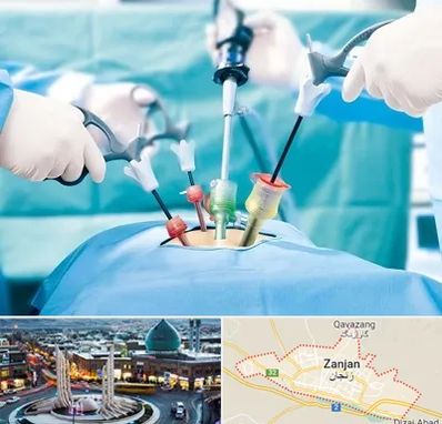 جراح فیبروم در زنجان