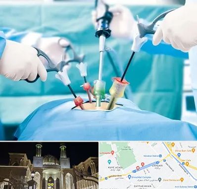 جراح فیبروم در زرگری شیراز