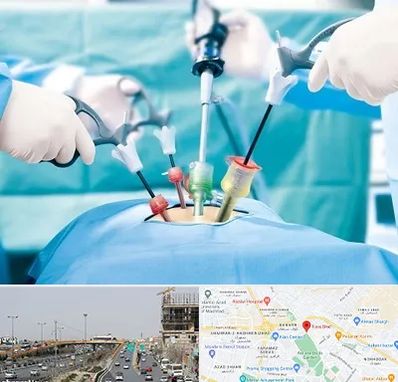 جراح فیبروم در بلوار توس مشهد