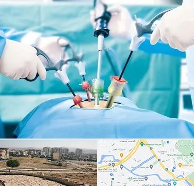 جراح فیبروم در کوی وحدت شیراز