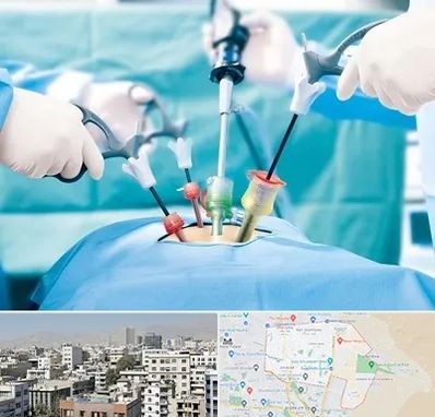 جراح فیبروم در منطقه 14 تهران