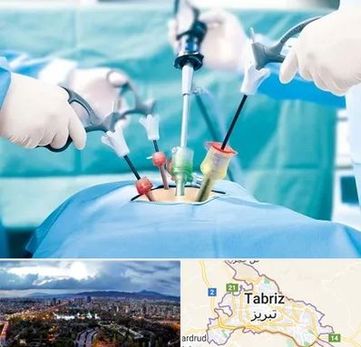 جراح فیبروم در تبریز