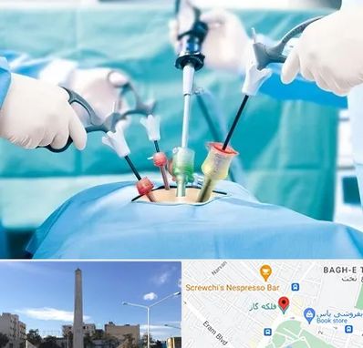 جراح فیبروم در فلکه گاز شیراز