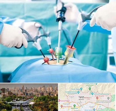 جراح فیبروم در منطقه 1 تهران