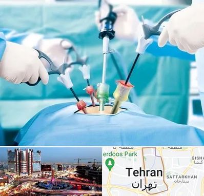 جراح فیبروم در صادقیه تهران