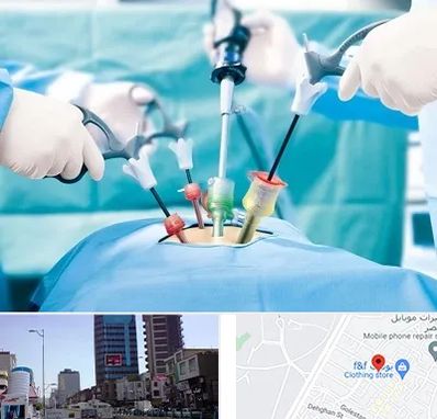 جراح فیبروم در چهارراه طالقانی کرج