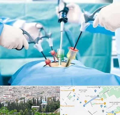 جراح فیبروم در محلاتی شیراز