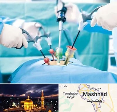 جراح فیبروم در مشهد