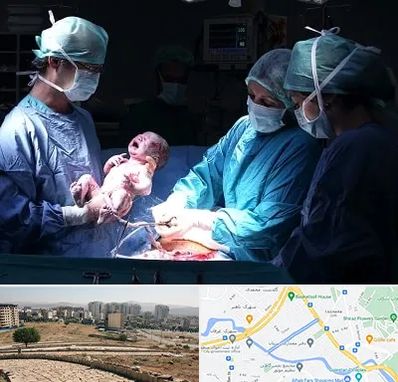 جراح سزارین در کوی وحدت شیراز