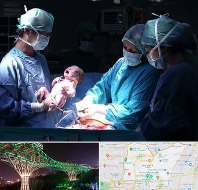 جراح سزارین در منطقه 3 تهران