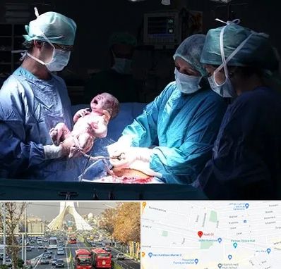 جراح سزارین در خیابان آزادی