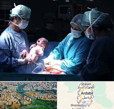 جراح سزارین در اردبیل