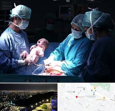 جراح سزارین در هفت تیر مشهد