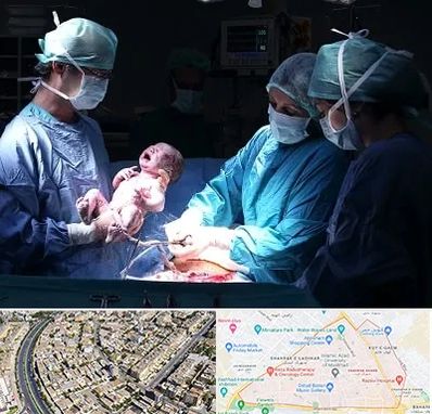 جراح سزارین در شهرک غرب مشهد