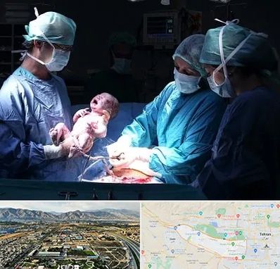 جراح سزارین در منطقه 21 تهران