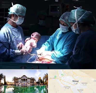 جراح سزارین در شیراز