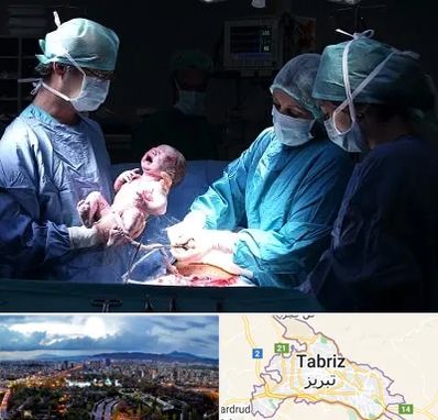 جراح سزارین در تبریز