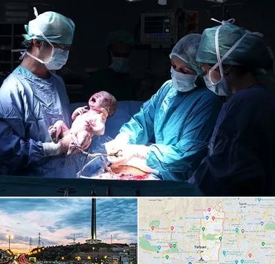 جراح سزارین در منطقه 2 تهران