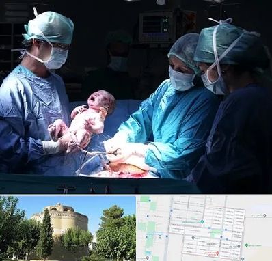 جراح سزارین در مرداویج اصفهان