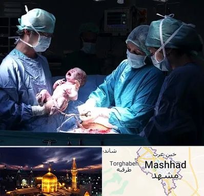 جراح سزارین در مشهد