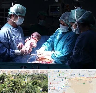جراح سزارین در منطقه 13 تهران