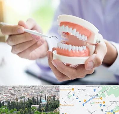 دندانسازی در محلاتی شیراز