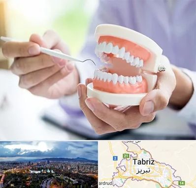 دندانسازی در تبریز