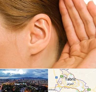 درمان وزوز گوش در تبریز