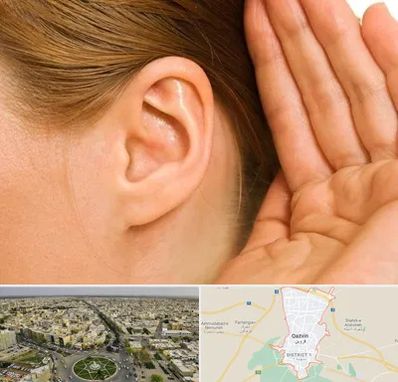 درمان وزوز گوش در قزوین