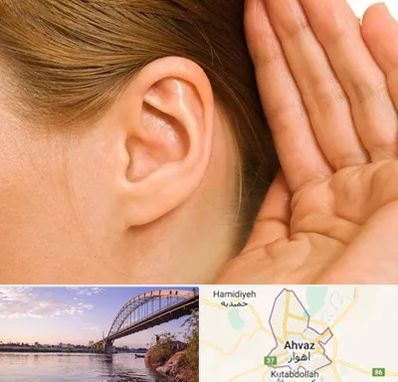 درمان وزوز گوش در اهواز