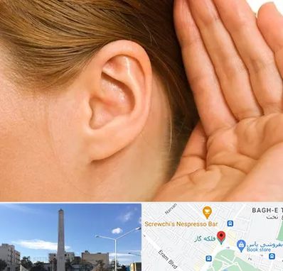 درمان وزوز گوش در فلکه گاز شیراز