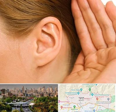 درمان وزوز گوش در منطقه 1 تهران 