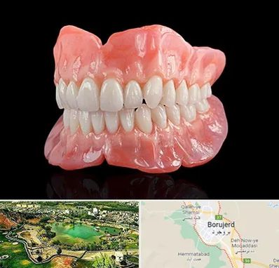 ساخت دندان مصنوعی در بروجرد