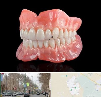 ساخت دندان مصنوعی در نظرآباد کرج 