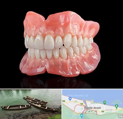 ساخت دندان مصنوعی در بندر انزلی