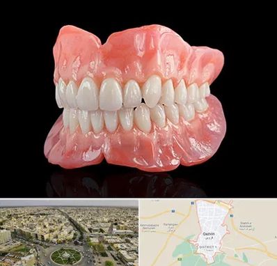 ساخت دندان مصنوعی در قزوین