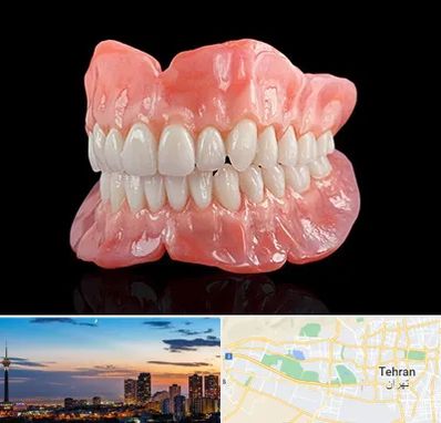 ساخت دندان مصنوعی در غرب تهران 