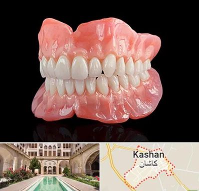 ساخت دندان مصنوعی در کاشان