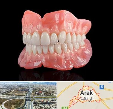 ساخت دندان مصنوعی در اراک
