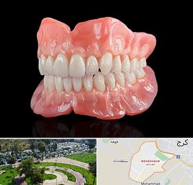 ساخت دندان مصنوعی در مهرشهر کرج 